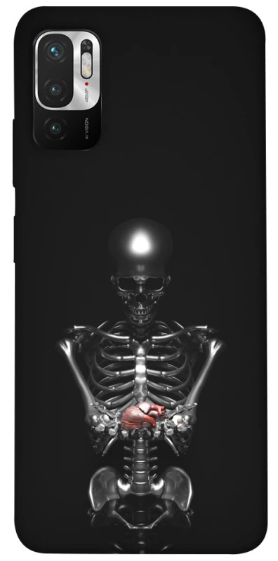 Чохол на Xiaomi Redmi Note 10 5G Скелетон фото 1 з 1