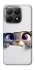 Чохол на Xiaomi 15T Zootopia фото 1 з 1