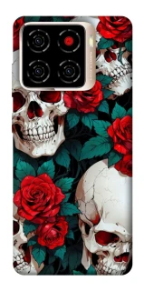Чохол на ZTE Blade A56 skull and rose фото 1 з 1