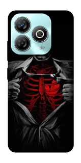 Чехол на ZTE Blade A75 4G Skeleton Heart фото 1 из 1