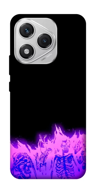 Чехол на Honor 400 Lite Funny moments фото 1 из 1