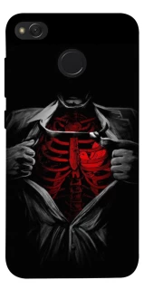 Чехол на Xiaomi Redmi 4X Skeleton Heart фото 1 из 1