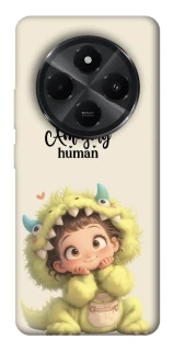 Чохол на Xiaomi Poco M7 You are amazing фото 1 з 1