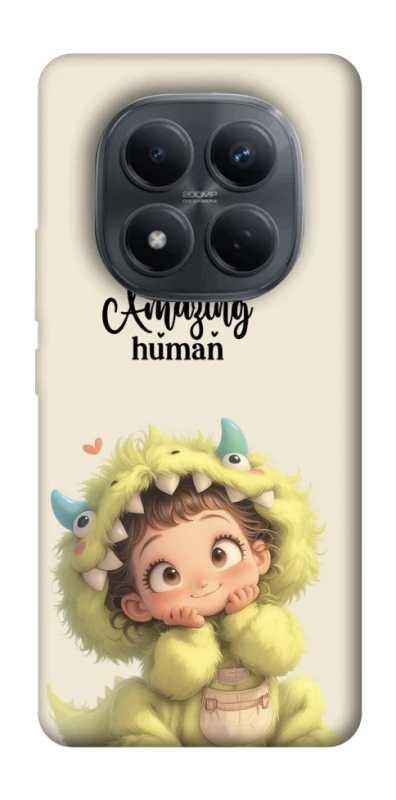 Чохол на Xiaomi Redmi Note 15 Pro 4G You are amazing фото 1 з 1