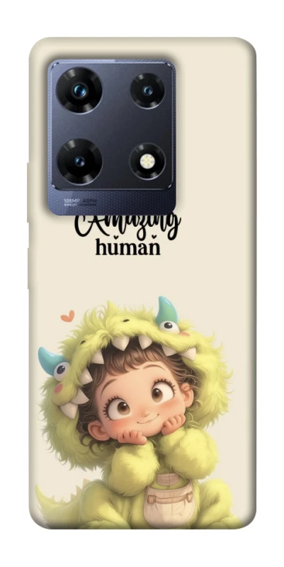 Чехол на Infinix Note 30 Pro You are amazing фото 1 из 1