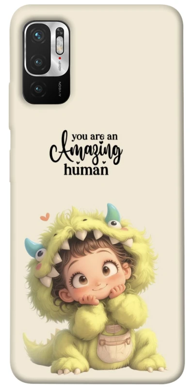 Чохол на Xiaomi Redmi Note 10 5G You are amazing фото 1 з 1