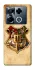 Чохол на Infinix Note 40 Pro 4G Harry Potter mood v1 фото 1 з 1