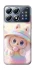 Чохол на Xiaomi POCO X8 Pro Candy Labubu фото 1 з 1