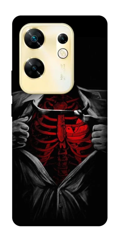 Чохол на Infinix Zero 30 4G Skeleton Heart фото 1 з 1