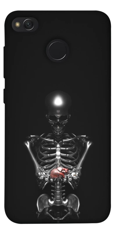 Чехол на Xiaomi Redmi 4X Скелетон фото 1 из 1