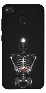Чехол на Xiaomi Redmi 4X Скелетон фото 1 из 1