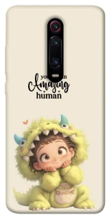 Чохол на Xiaomi Redmi K20 / K20 Pro / Mi9T / Mi9T Pro You are amazing фото 1 з 1