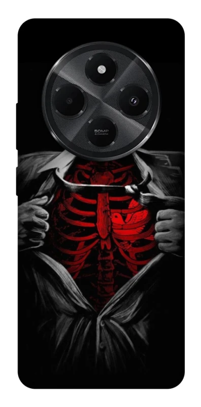 Чохол на Xiaomi Redmi A3 Pro Skeleton Heart фото 1 з 1