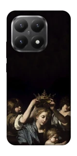 Чохол на Xiaomi 15T Art collage ver.1 фото 1 з 1