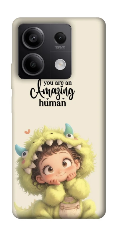 Чохол на Xiaomi Redmi Note 13 5G You are amazing фото 1 з 1