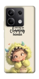 Чохол на Xiaomi Redmi Note 13 5G You are amazing фото 1 з 1