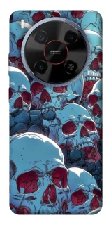Чехол на ZTE Blade V70 Max Skulls v2 фото 1 из 1