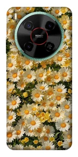 Чохол на ZTE Nubia V70 Max Camomile фото 1 з 1