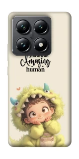 Чохол на Xiaomi 14T Pro You are amazing фото 1 з 1