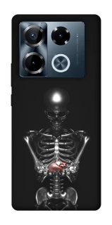 Чохол на Infinix Note 40 Pro 4G Скелетон фото 1 з 1