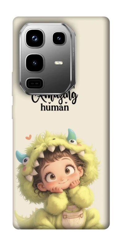 Чохол на Infinix Note 50 Pro You are amazing фото 1 з 1