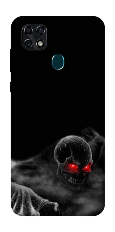 Чохол на ZTE Blade 20 Smart Skeleton v3 фото 1 з 1