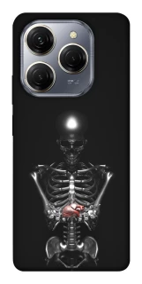 Чохол на TECNO Spark 20 Pro Скелетон фото 1 з 1