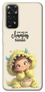 Чохол на Xiaomi Redmi Note 11 (Global) / Note 11S You are amazing фото 1 з 1