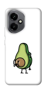 Чохол на Honor 400 Авокадо із сюрпризом фото 1 з 1