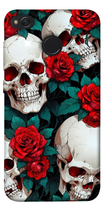 Чохол на Xiaomi Redmi 4X skull and rose фото 1 з 1