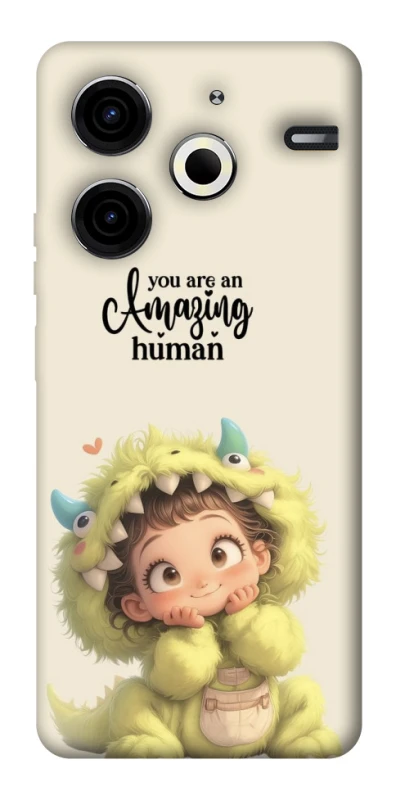 Чохол на TECNO Pova 6 Neo (LI6) You are amazing фото 1 з 1