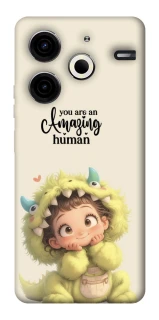 Чохол на TECNO Pova 6 Neo (LI6) You are amazing фото 1 з 1