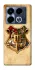 Чохол на Infinix Note 40 4G Harry Potter mood v1 фото 1 з 1