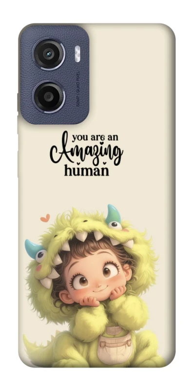 Чохол на Motorola Moto G05 You are amazing фото 1 з 1