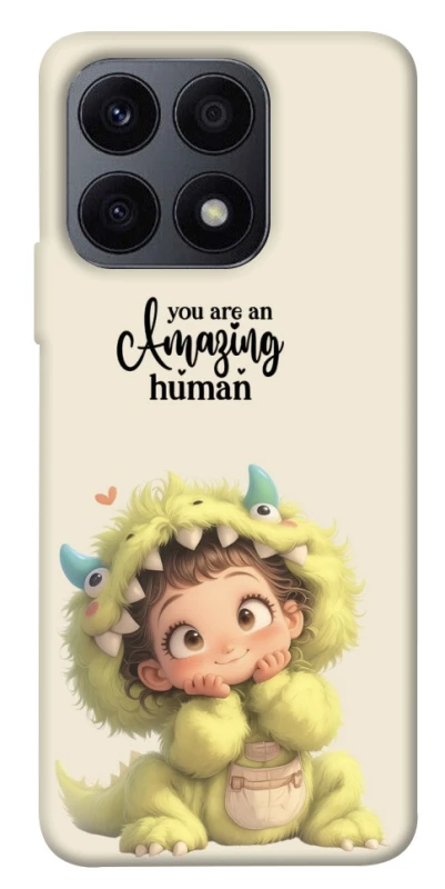Чохол на Huawei Honor X8a You are amazing фото 1 з 1