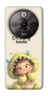 Чохол на ZTE Nubia Focus Pro You are amazing фото 1 з 1