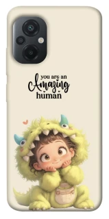 Чехол на Xiaomi Poco M5 You are amazing фото 1 из 1