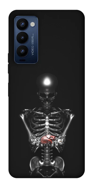 Чохол на TECNO Camon 18 Pro Скелетон фото 1 з 1