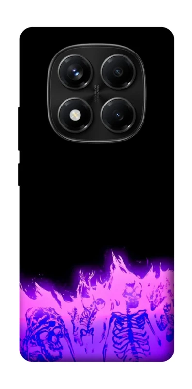 Чохол на Xiaomi Redmi Note 14 Pro 4G Funny moments фото 1 з 1