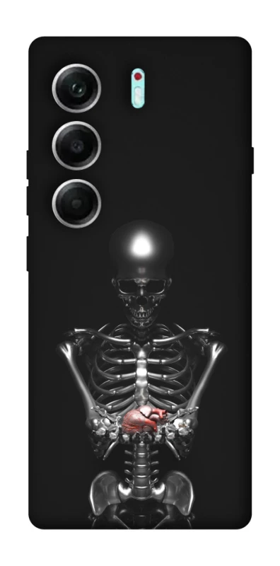 Чохол на Tecno Camon 40 Pro Скелетон фото 1 з 1