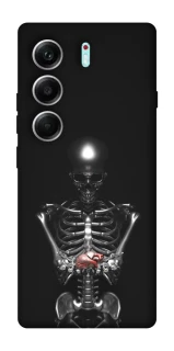 Чохол на Tecno Camon 40 Pro Скелетон фото 1 з 1