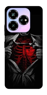 Чохол на ZTE Nubia V60 Desing Skeleton Heart фото 1 з 1