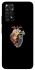 Чохол на Xiaomi Redmi Note 11 (Global) / Note 11S Heart with flowers фото 1 з 1