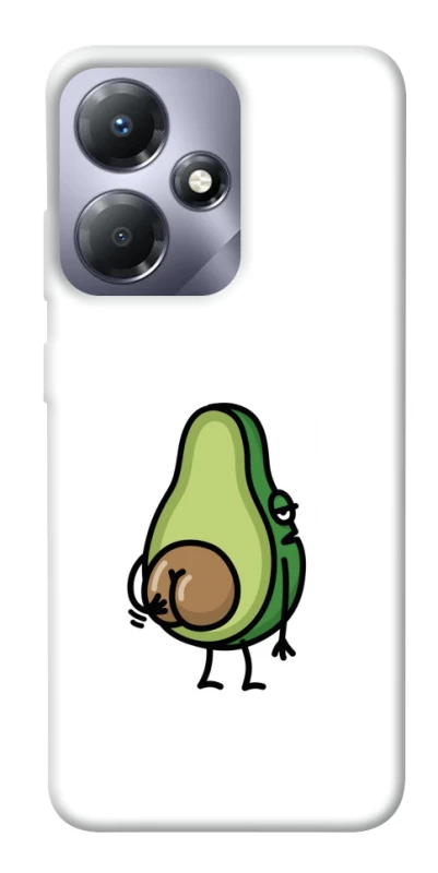 Чохол на Infinix Hot 30i Авокадо із сюрпризом фото 1 з 1