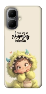 Чохол на Infinix Smart 10 You are amazing фото 1 з 1