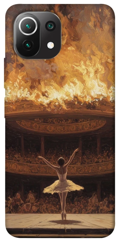 Чохол на Xiaomi Mi 11 Lite Ballet фото 1 з 1