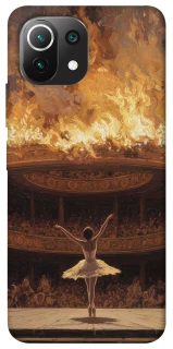 Чохол на Xiaomi Mi 11 Lite Ballet фото 1 з 1