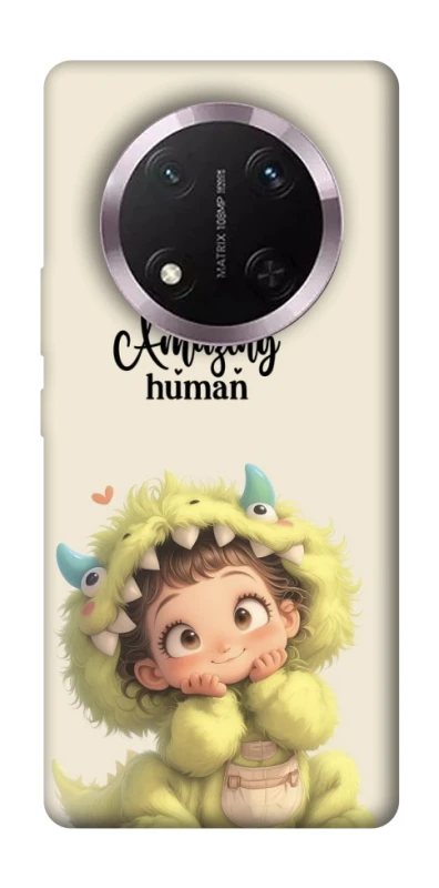 Чохол на Honor X9c You are amazing фото 1 з 1