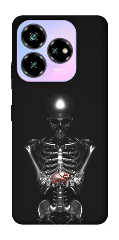 Чохол на ZTE Nubia V60 Desing Скелетон фото 1 з 1