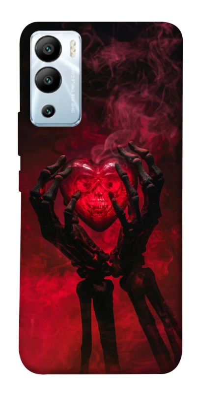 Чохол на Infinix Hot 12i Heart in the hands of a skeleton фото 1 з 1